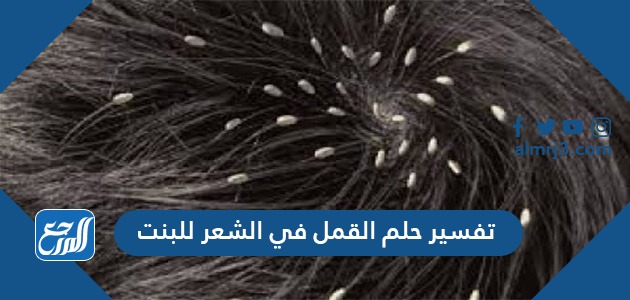 تفسير حلم القمل في الشعر للبنت