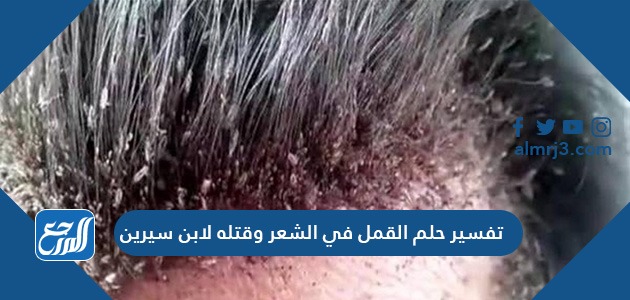 تفسير حلم القمل في الشعر وقتله لابن سيرين
