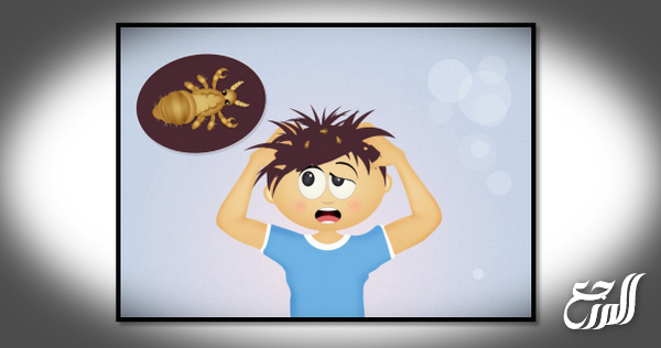 طريقة التخلص من القمل والصيبان في يوم واحد نهائيا من أول مرة