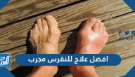 افضل علاج للنقرس مجرب 2025 وأهم أعراض الإصابة بمرض النقرس