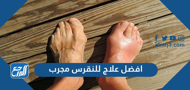 افضل علاج للنقرس مجرب