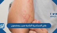 علاج الحساسية الجلدية مجرب ومضمون