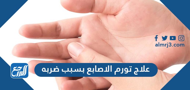 علاج تورم الاصابع بسبب ضربه