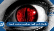 علامات خروج العين من الجسد وشفاء المريض