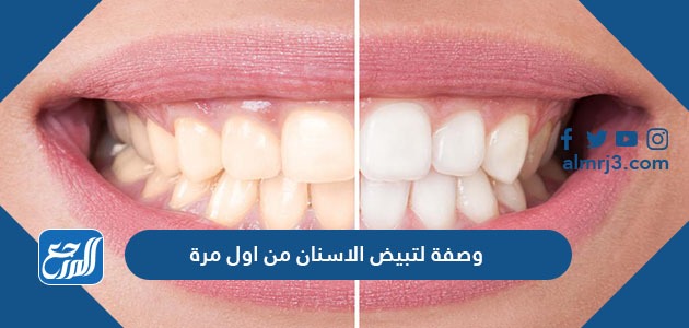 وصفة لتبيض الاسنان من اول مرة