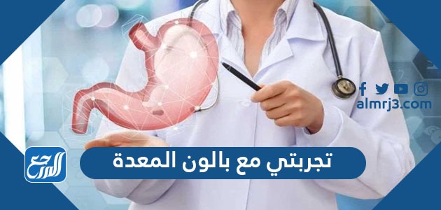 تجربتي مع بالون المعدة