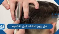 هل يجوز الحلاقه قبل الاضحيه