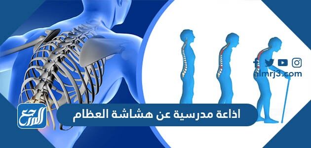 اذاعة مدرسية عن هشاشة العظام كاملة