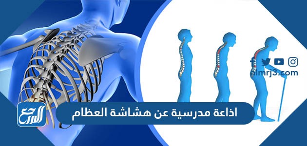 اذاعة مدرسية عن هشاشة العظام كاملة