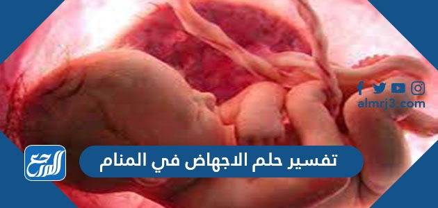 تفسير حلم الاجهاض في المنام