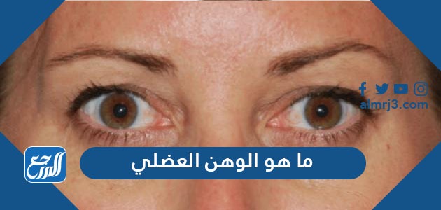 ما هو الوهن العضلي