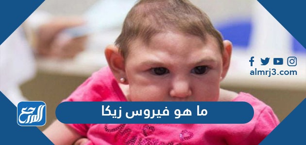ما هو فيروس زيكا