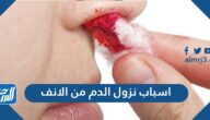 ما هي اسباب نزول الدم من الانف وما اعراضه وطرق علاجه والوقاية منه
