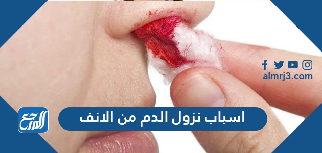 اسباب نزول الدم من الانف
