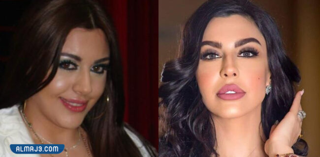 ليلى اسكندر قبل وبعد التجميل