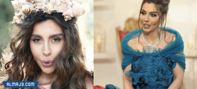 ليلى اسكندر قبل وبعد التجميل