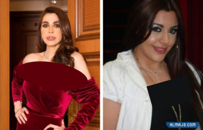 ليلى اسكندر قبل وبعد