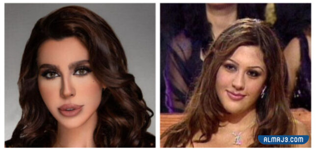 ليلى اسكندر قبل وبعد