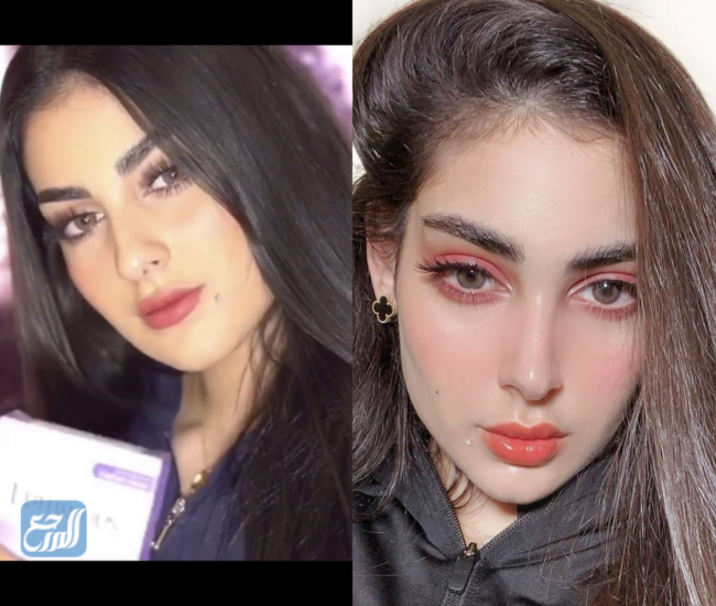 زينب العلوان قبل وبعد