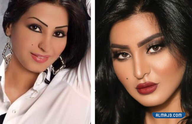 صور ريم عبدالله قبل وبعد