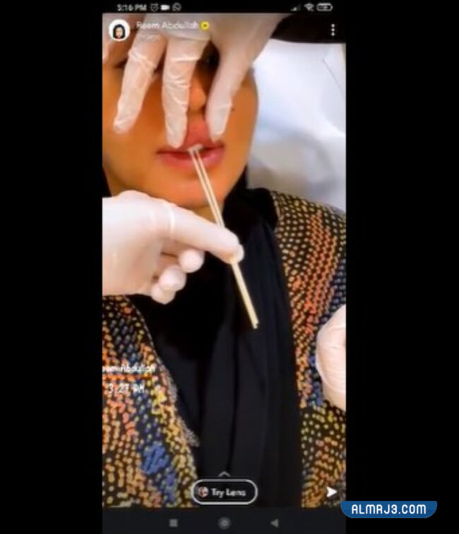 ريم عبدالله قبل وبعد