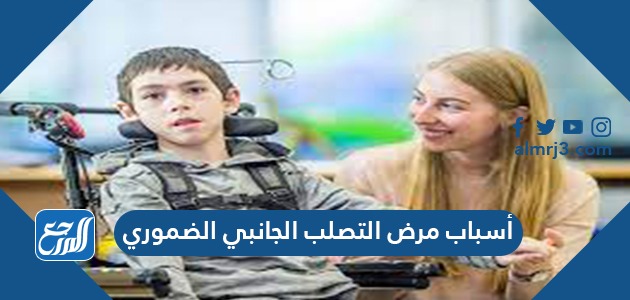 أسباب مرض التصلب الجانبي الضموري