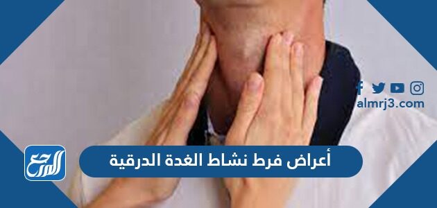 أعراض فرط نشاط الغدة الدرقية