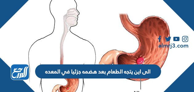 إلى أين يتجه الطعام بعد هضمه جزئيا في المعدة