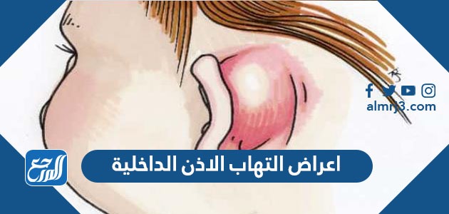 اعراض التهاب الاذن الداخلية