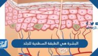 البشرة هي الطبقة السطحية للجلد