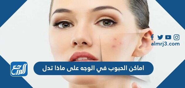 اماكن الحبوب في الوجه على ماذا تدل