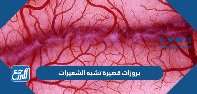 بروزات قصيرة تشبه الشعيرات