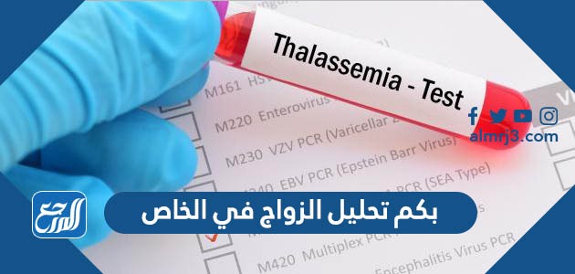 بكم تحليل الزواج في الخاص