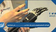 تقنية اليد الصناعية وتعويض شخص فقد ذراعه من ……… في علم الأحياء
