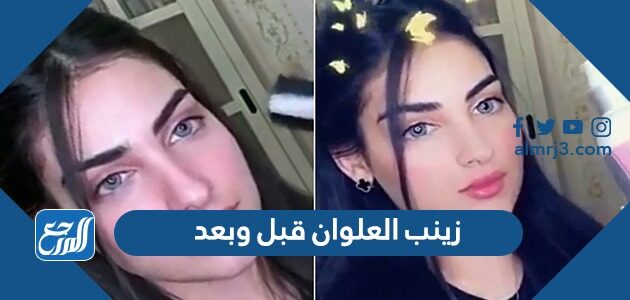 زينب العلوان قبل وبعد