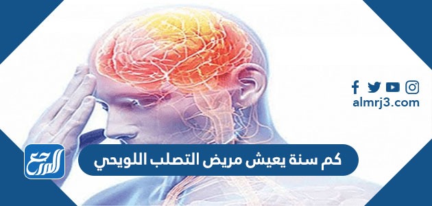 كم سنة يعيش مريض التصلب اللويحي