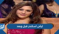 ليلى اسكندر قبل وبعد
