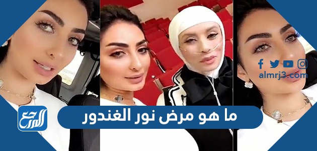 ما هو مرض نور الغندور