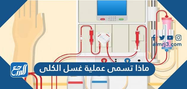 ماذا تسمى عملية غسل الكلى من 5 حروف