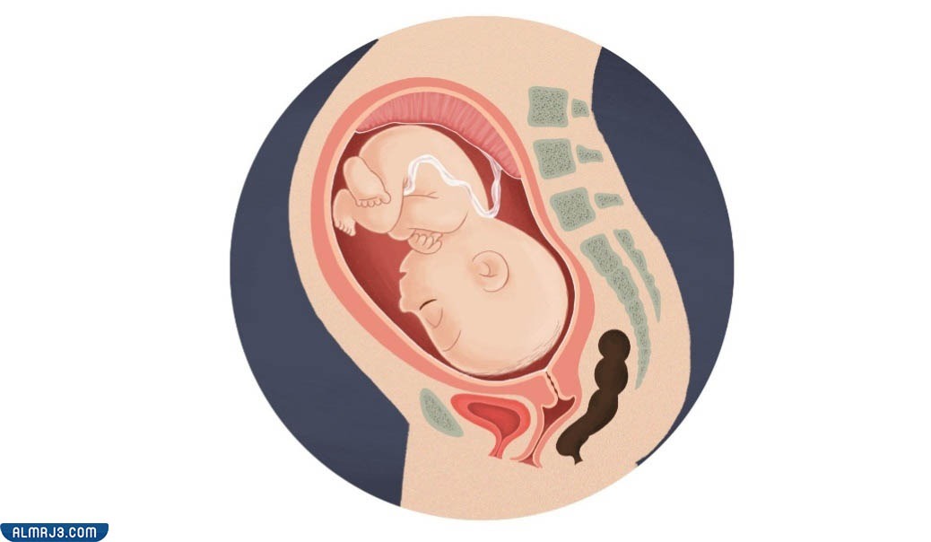 الوضع الخلفي للجنين في بطن الأم