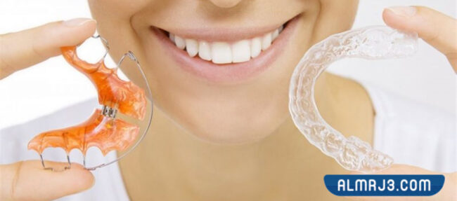 تقويم الأسنان المتحرك 
