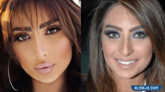 نور الغندور قبل وبعد