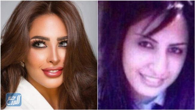 فوز الفهد قبل وبعد 