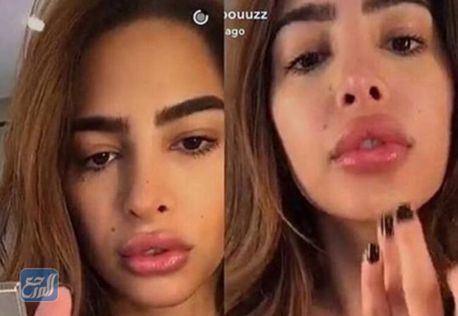 فوز الفهد قبل وبعد 