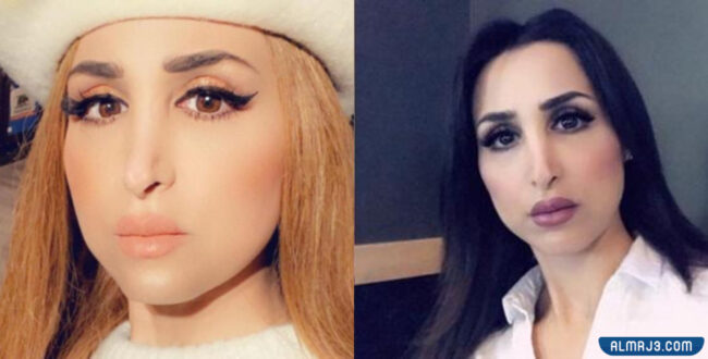 هند القحطاني قبل وبعد