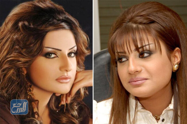 صور امل العوضي قبل التجميل