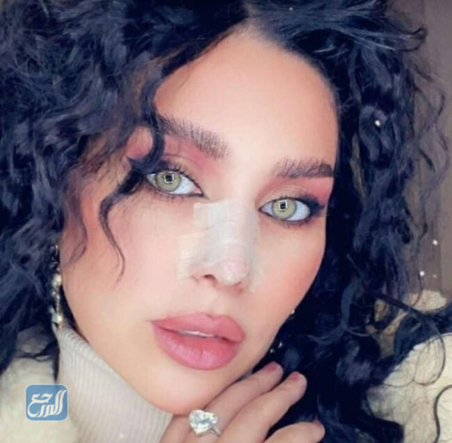 عملية تجميل الدكتورة خلود تثير الجدل