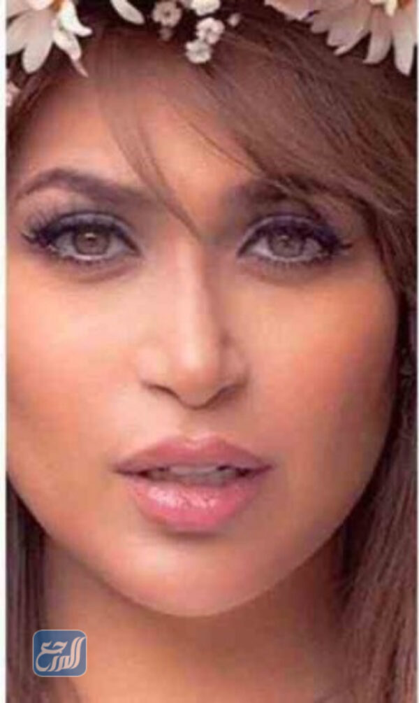 دكتورة خلود قبل وبعد