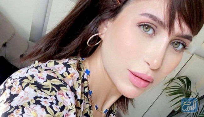 دكتورة خلود قبل وبعد