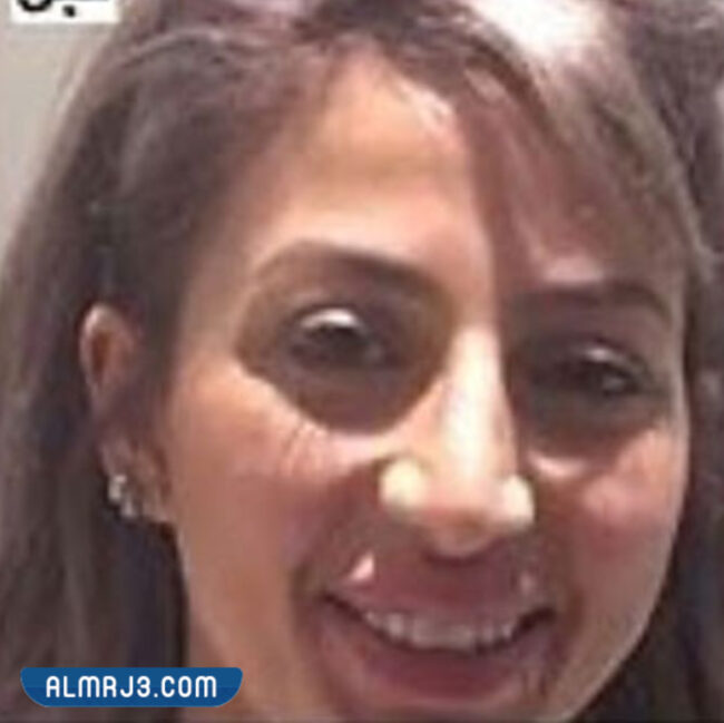 مودل روز قبل التجميل